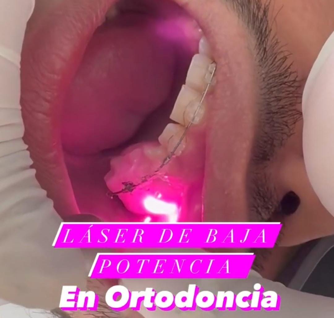 Terapia Láser